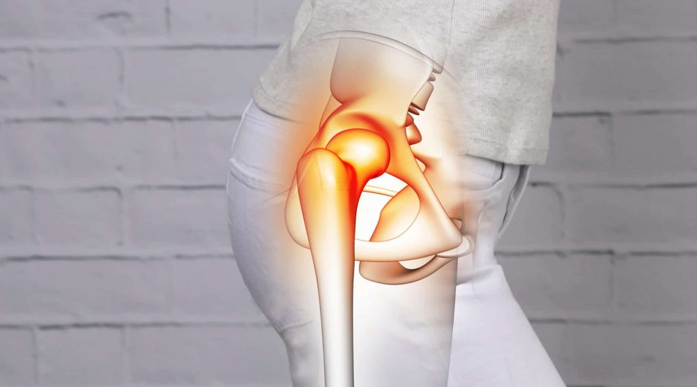 Hip Pain Treatment